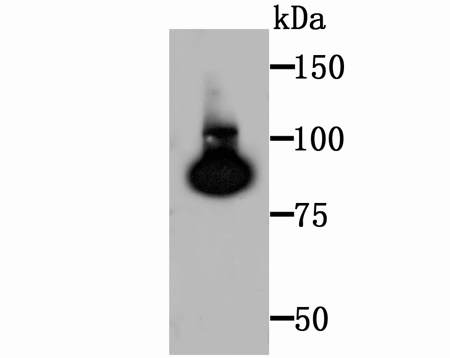 Anti-TGM2 Antibody (9X389)