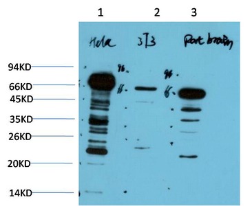 Anti-UBB Antibody (8Y6)