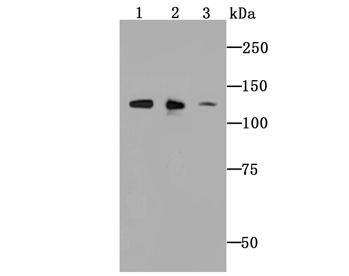 Anti-ULK1 Antibody (6P282)