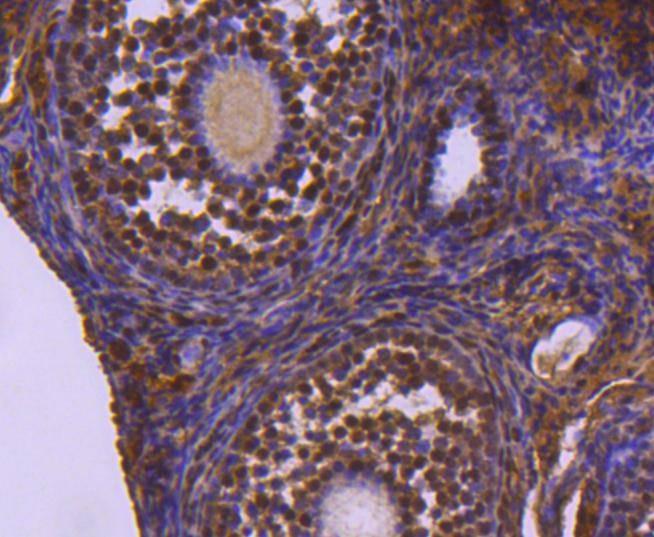 Anti-Ubiquitin Activating Enzyme E1/UBA1 Antibody (1V154)