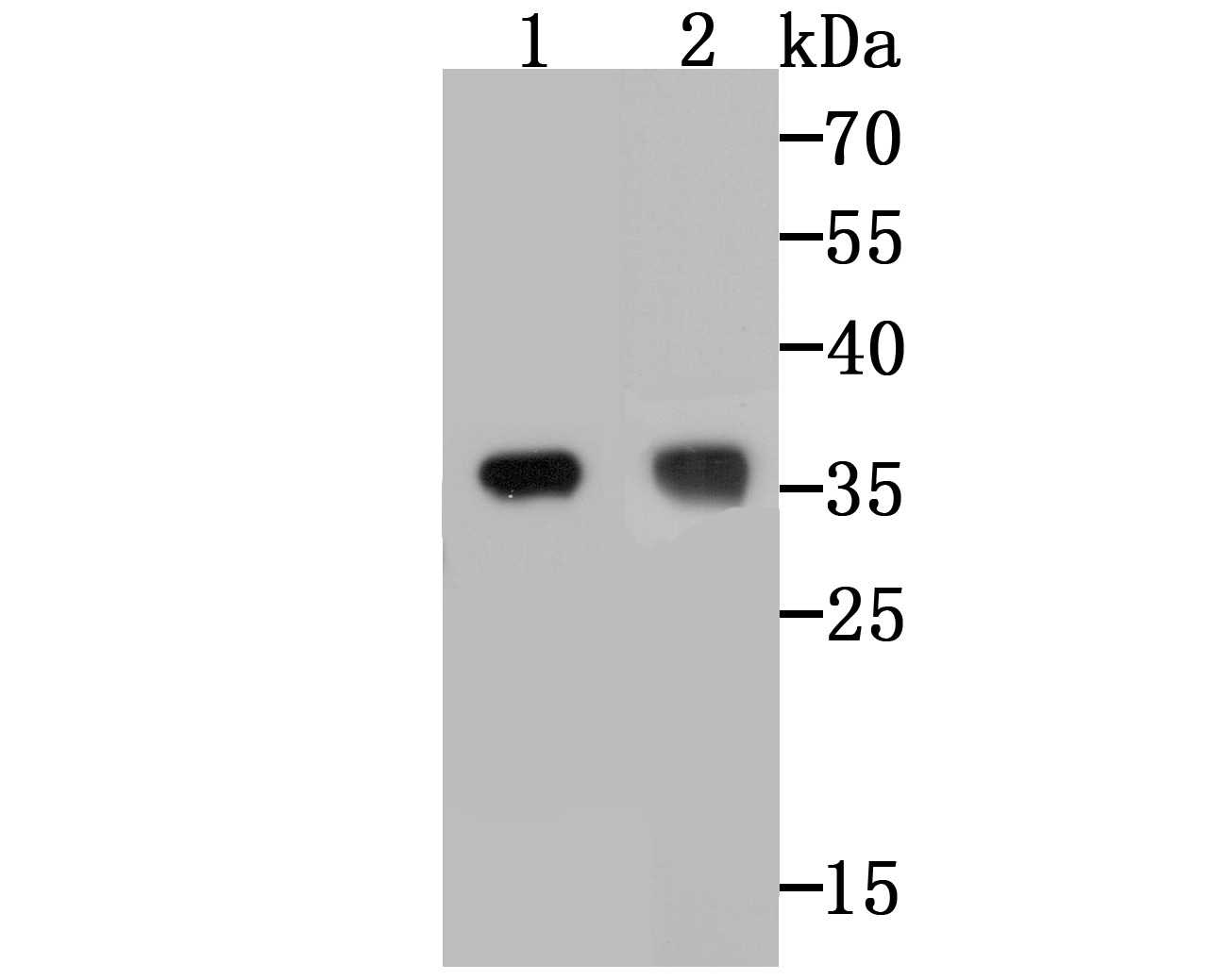 Anti-TREX1 Antibody (9A314)