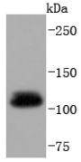 Anti-Ubiquitin Activating Enzyme E1/UBA1 Antibody (1V154)