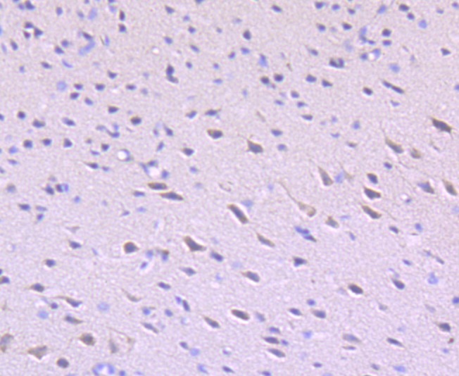 Anti-ULK1 Antibody (6P282)