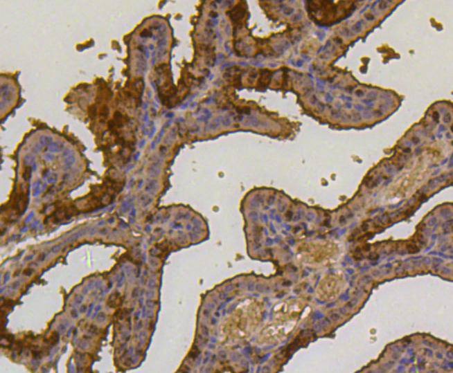 Anti-UBB Antibody (3A357)