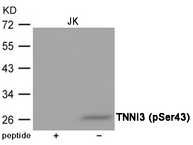 Anti-Phospho-TNNI3 (Ser43) Polyclonal Antibody 2