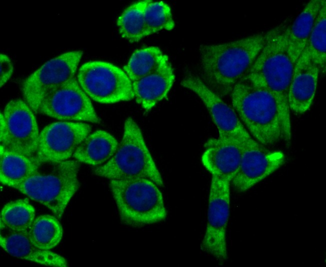 Anti-UQCRFS1 Antibody (8G153)