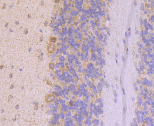 Anti-UQCRFS1 Antibody (8G153)