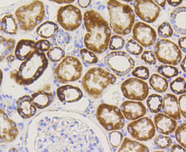 Anti-TOMM20 Antibody (6C702)