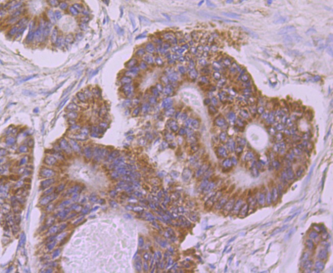 Anti-UQCRFS1 Antibody (8G153)
