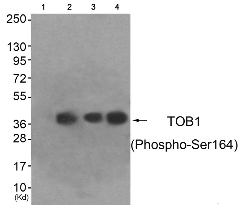 Anti-Phospho-TOB1 (Ser164) Polyclonal Antibody