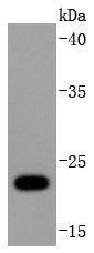 Anti-Ubiquitin D Antibody (7G418)