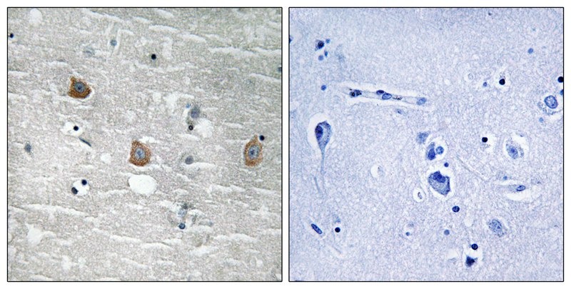 Anti-Phospho-TOB1 (Ser164) Polyclonal Antibody