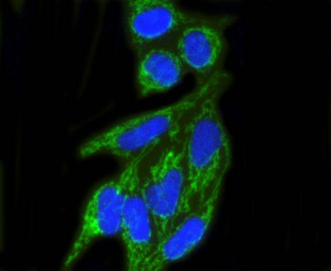 Anti-TOMM20 Antibody (6C702)
