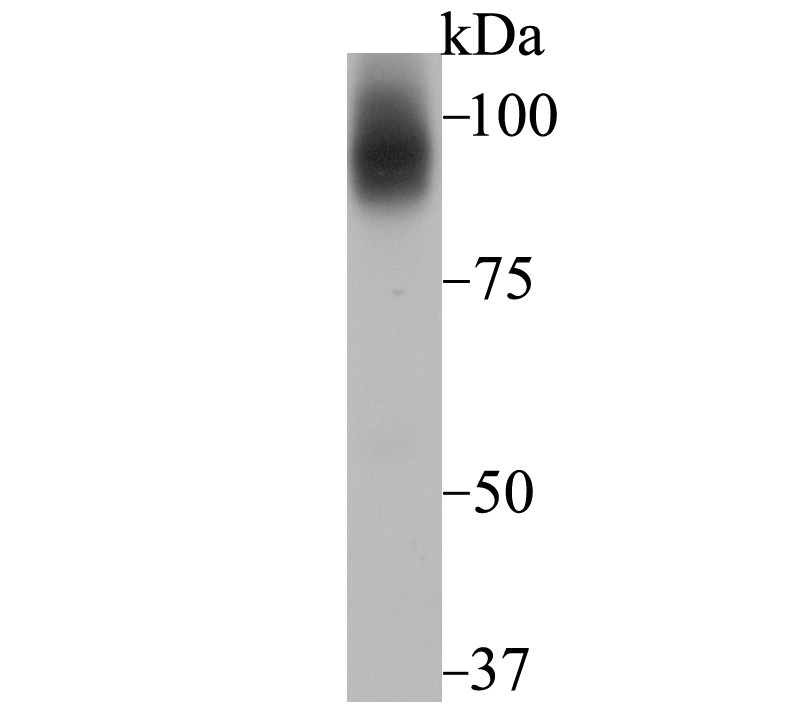 Anti-Transferrin R2 Antibody (5U818)