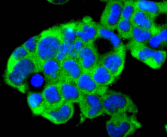 Anti-Ubiquitin D Antibody (7G418)