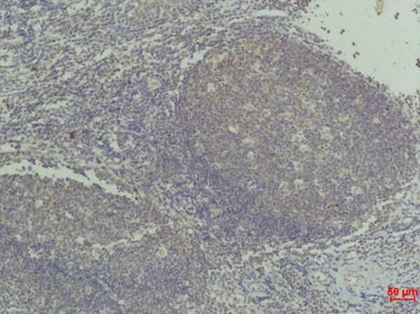 Anti-TNF alpha Antibody (6X125)