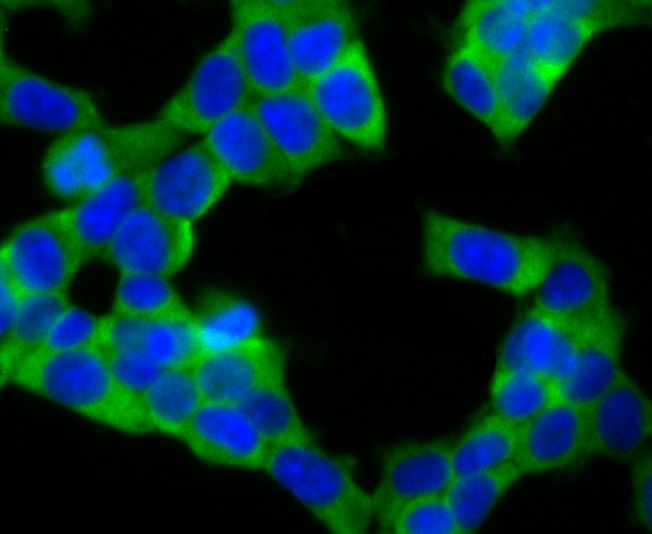 Anti-UQCRFS1 Antibody (8G153)