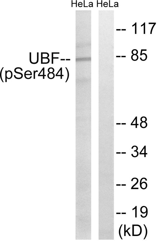 Anti-Phospho-Nucleolar transcription factor 1 (Ser484) Polyclonal Antibody
