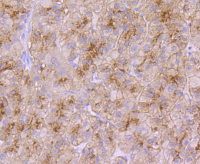 Anti-Transferrin R2 Antibody (5U818)