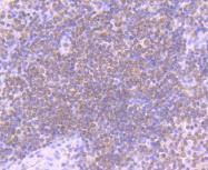 Anti-STIM1 Antibody (8E689)