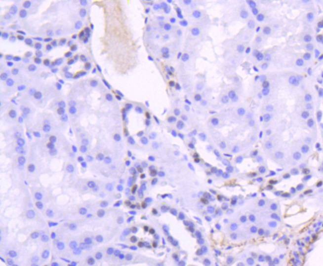 Anti-TCF7L2 Antibody (8D555)