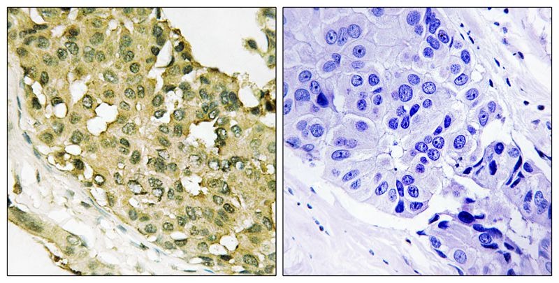 Anti-Phospho-Stathmin 1 (Ser63) Polyclonal Antibody