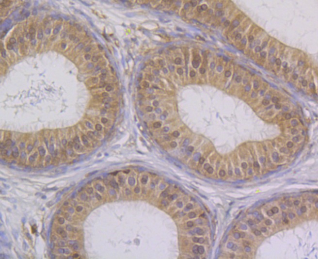 Anti-STUB1 Antibody (5M430)