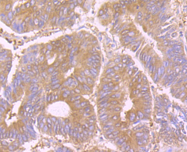 Anti-STIP1 Antibody (2K15)