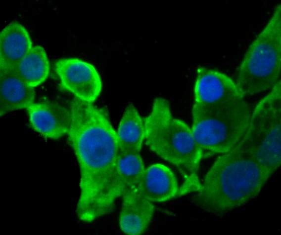 Anti-STUB1 Antibody (5M430)