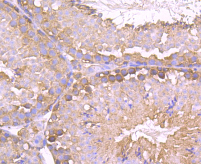 Anti-TCTP/TPT1 Antibody (7X932)