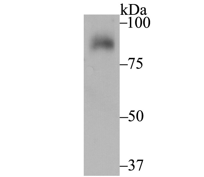 Anti-SUN2 Antibody (2Y616)