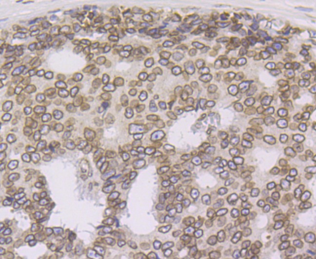 Anti-SUN2 Antibody (2Y616)
