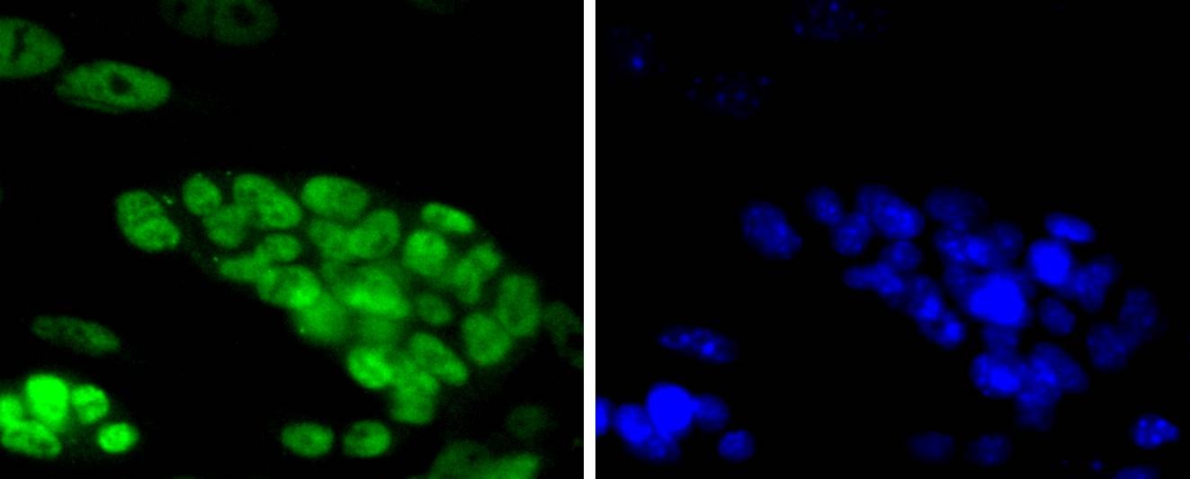 Anti-TCF7L2 Antibody (8D555)