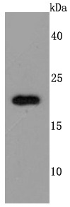 Anti-TIMP-2 Antibody (9V262)