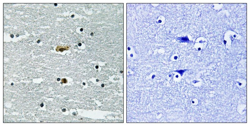Anti-Phospho-STK39 (Ser309) Polyclonal Antibody