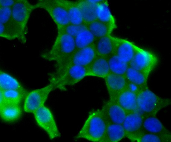Anti-STUB1 Antibody (5M430)