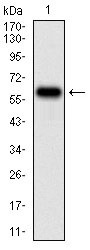 Anti-TIE1 Antibody (6A314)