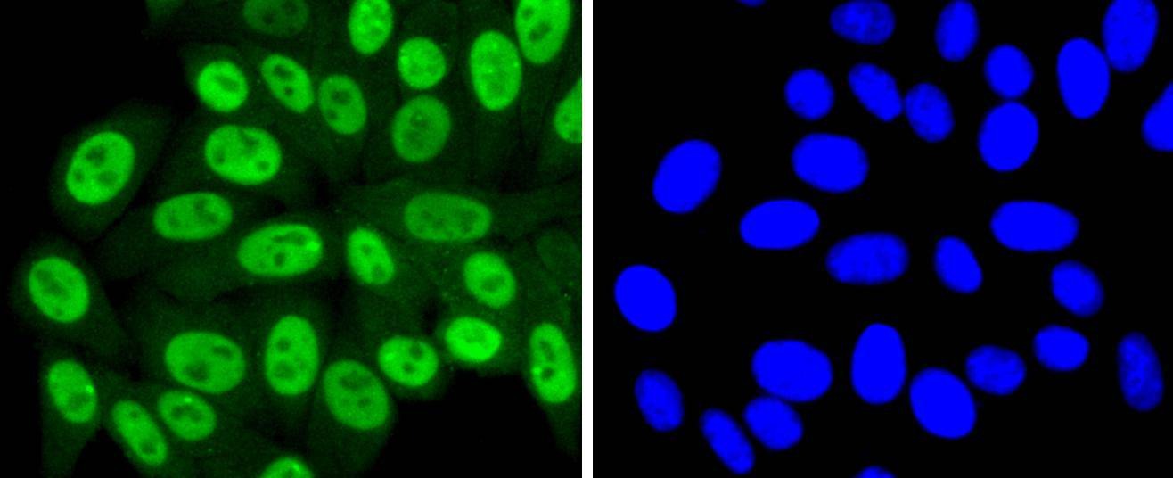 Anti-SUMO4 Antibody (4W157)