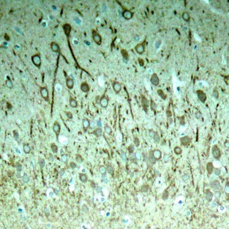 Anti-Phospho-MAPT (Thr231) Polyclonal Antibody