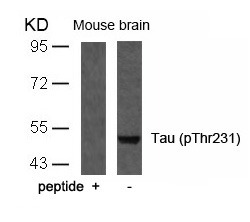 Anti-Phospho-MAPT (Thr231) Polyclonal Antibody