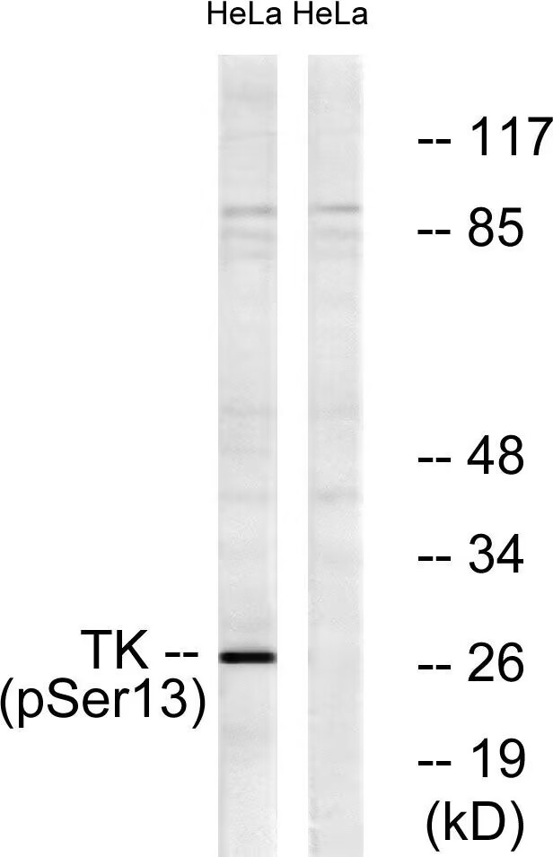 Anti-Phospho-TK1 (Ser13) Polyclonal Antibody