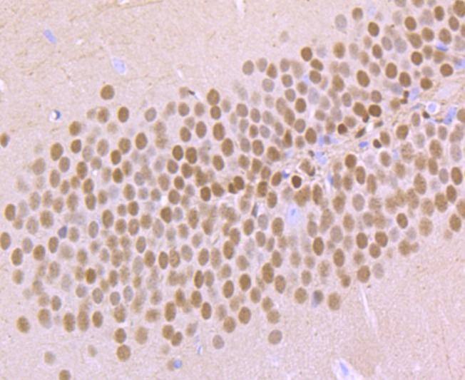Anti-TBR1 Antibody (1Z281)