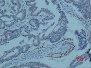 Anti-Survivin Antibody (9D807)