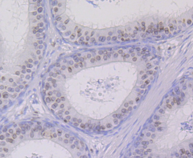 Anti-SUN2 Antibody (2Y616)