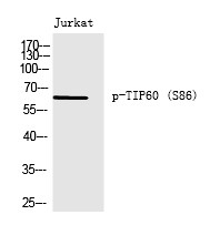 Anti-Phospho-KAT5 (Ser86) Polyclonal Antibody