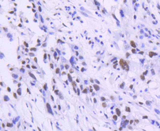 Anti-TCF7L2 Antibody (8D555)