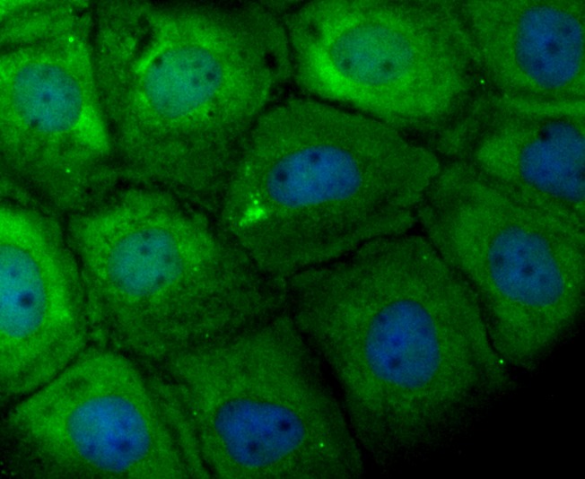 Anti-TCTP/TPT1 Antibody (7X932)