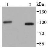 Anti-STIM1 Antibody (8E689)