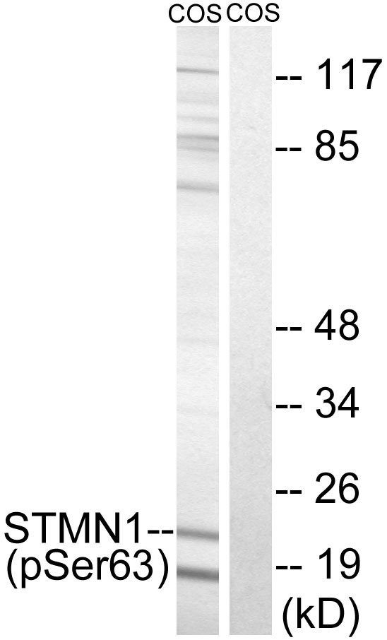 Anti-Phospho-Stathmin 1 (Ser63) Polyclonal Antibody