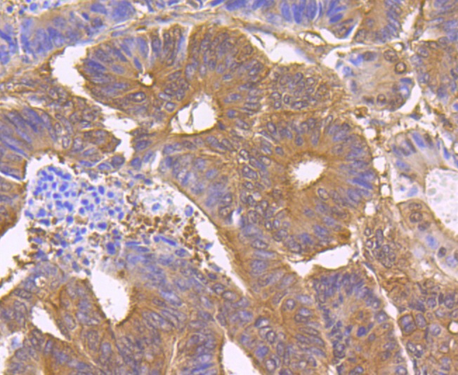 Anti-STUB1 Antibody (5M430)